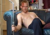 Best suppurating actor? Chester (Paul Bettany) resists treatment on the couch